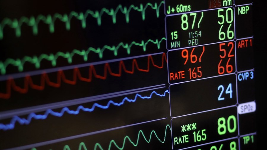 Le taux de mortalité des maladies du cœur et AVC a reculé au Canada