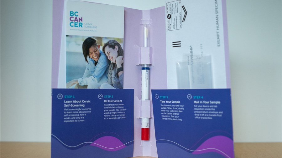 Hausse des décès du cancer du col de l'utérus chez les 35-44 ans au Canada